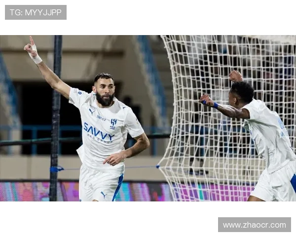 本泽马伤情恢复需10至15天 达乌萨里休养3至4周 本泽马伤情恢复需10至15天 达乌萨里休养3至4周